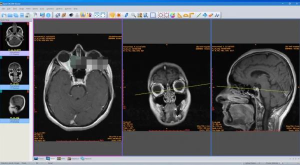 Sante DICOM Viewer Pro专业版